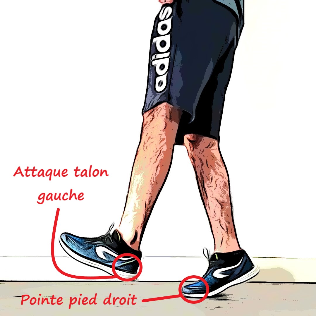 type de talon