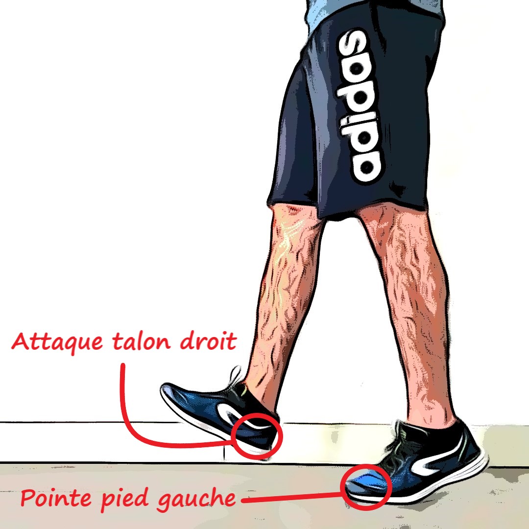 Est-ce que la marche sur la pointe des pieds est inévitable